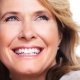 veneers_1 __Sunrise Dental | Chapel Hill | Durham | Raleigh | Cary, NC